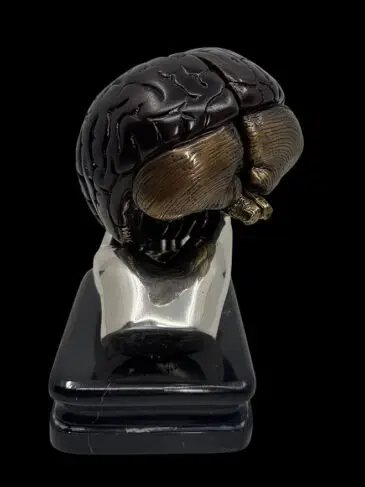 brain in doctor's hand